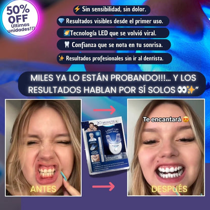Pack Sonrisa Perfecta 🌀Dientes más blancos en tan sólo 20 minutos🌀
