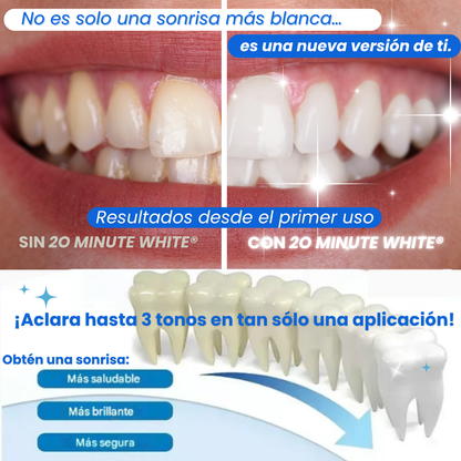 Pack Sonrisa Perfecta 🌀Dientes más blancos en tan sólo 20 minutos🌀